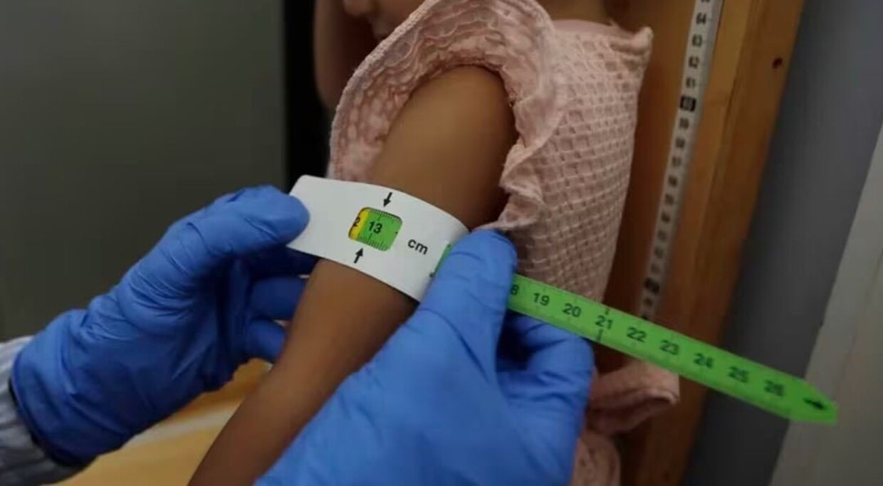 Preocupante: 232 menores de cinco años murieron por desnutrición en 2023, según la Defensoría