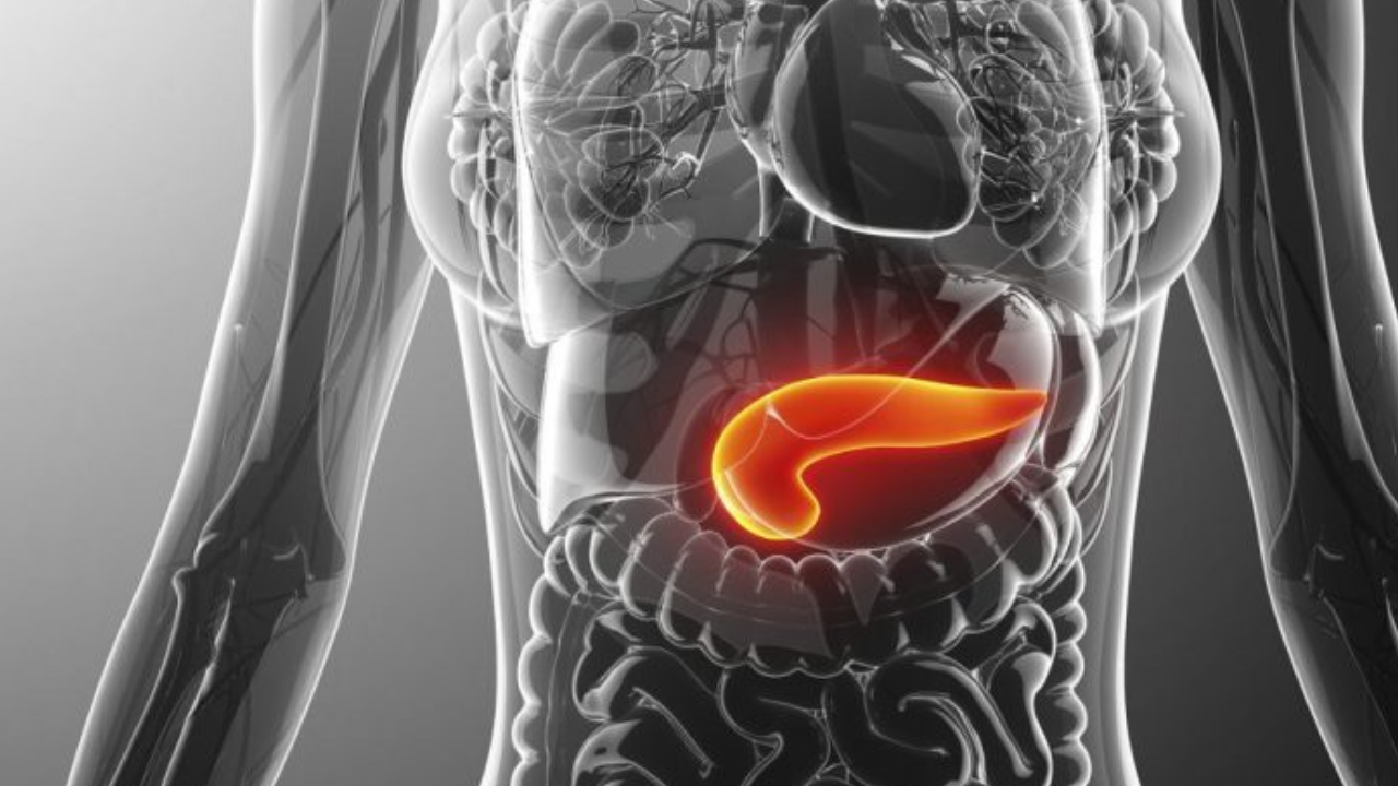 Preste atención: este es el síntoma temprano con el que puede identificar el cáncer de páncreas