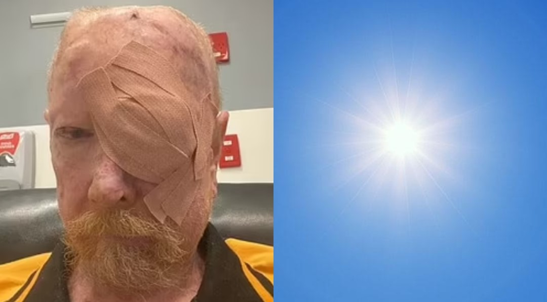 A un hombre le detectaron 200 cáncer de piel: ¿cómo sucedió esto?