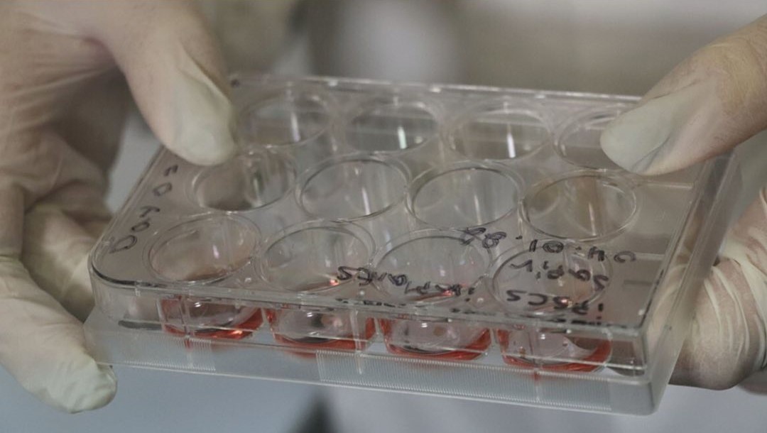 Científicas desarrollaron un hidrogel que puede recuperar tejido neuronal dañado: le contamos lo que se sabe