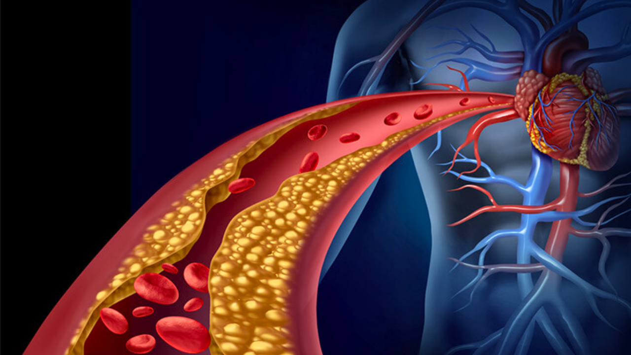 Recomendación: esta es la vitamina que ayuda a regular el colesterol y los triglicéridos