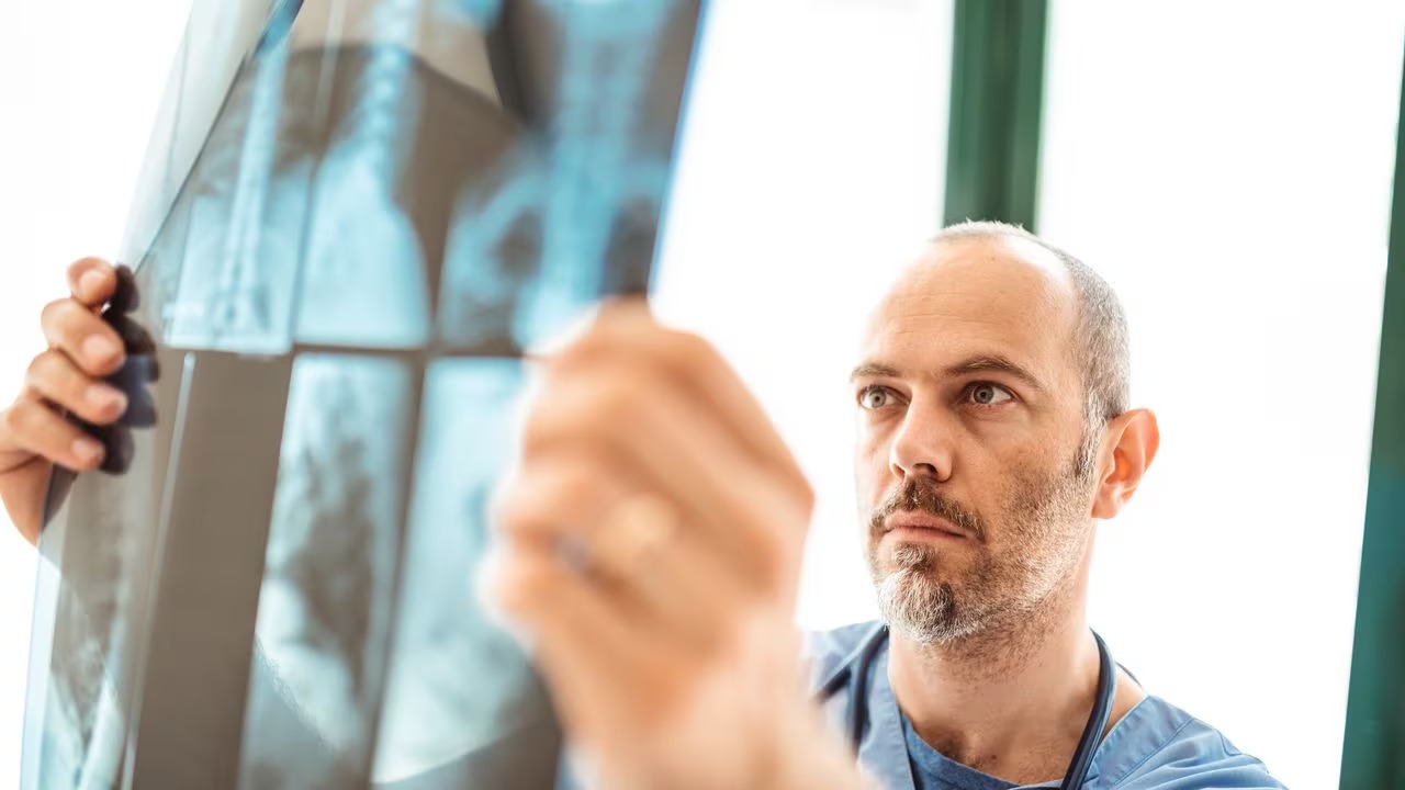 Cáncer en los huesos: estos son los síntomas de esta enfermedad