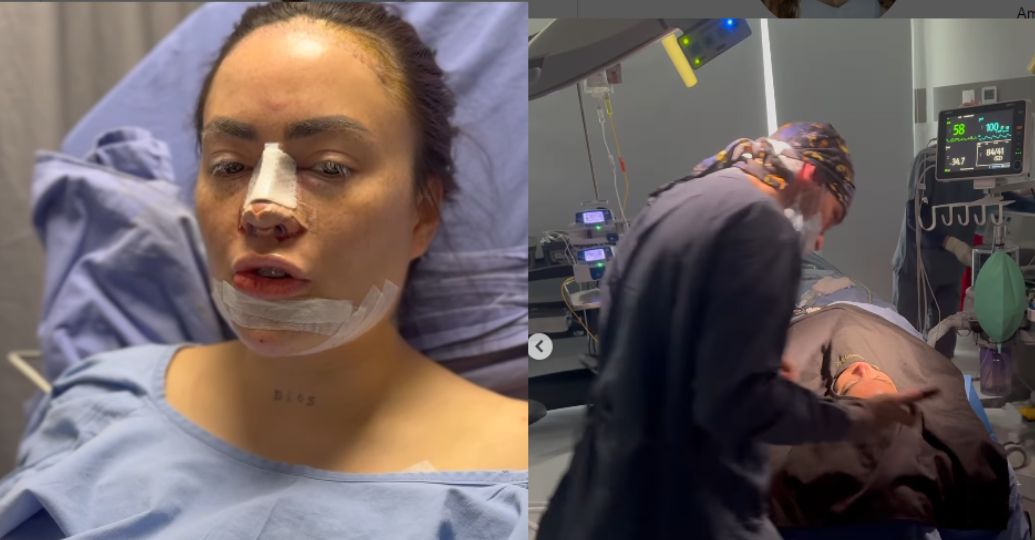 'Epa Colombia' contó cuánto le costaron sus recientes cirugías plásticas