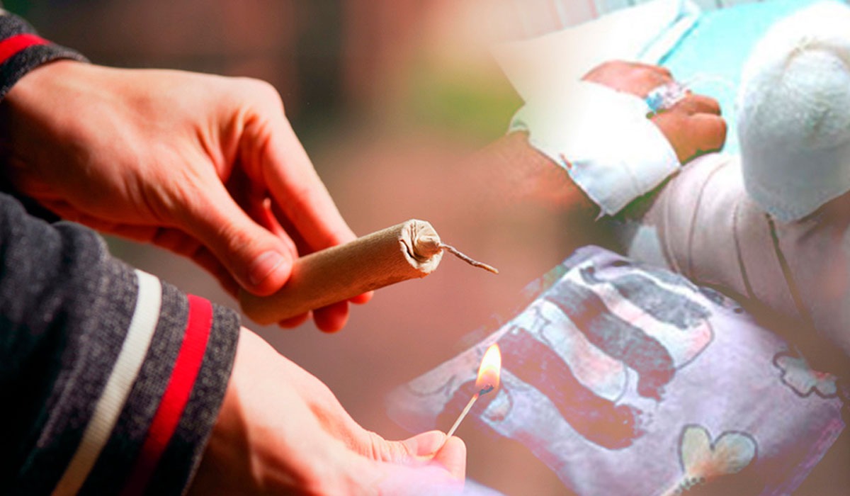 ¿Se quemó con pólvora en Navidad? Tranquilícese: le indicamos qué podría hacer en este caso