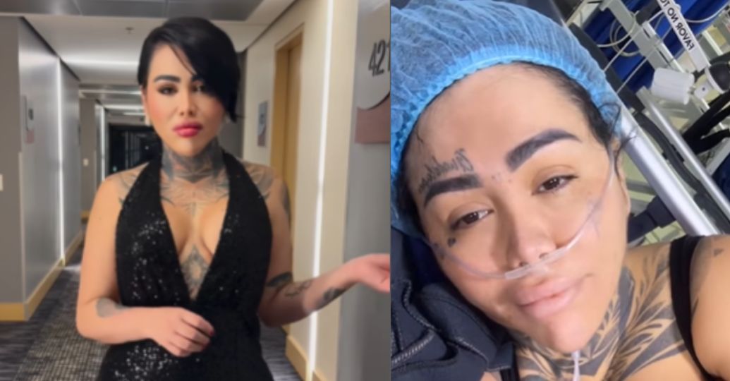 Yina Calderón reveló impresionantes imágenes de su cirugía de extracción de biopolímeros