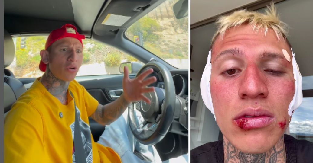 ‘La Liendra’ apareció golpeado en redes sociales y generó preocupación entre sus fanáticos