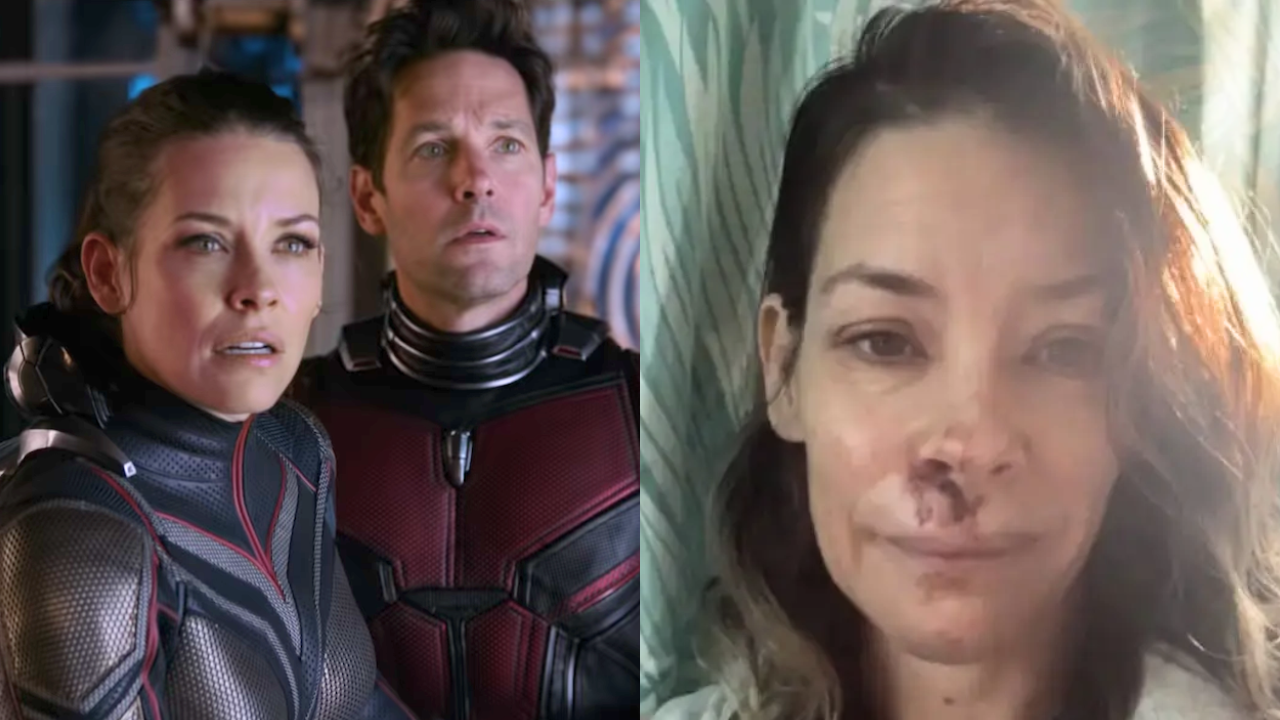 Famosa actriz de Marvel reveló que tiene daño cerebral tras sufrir una fuerte caída en Hawái