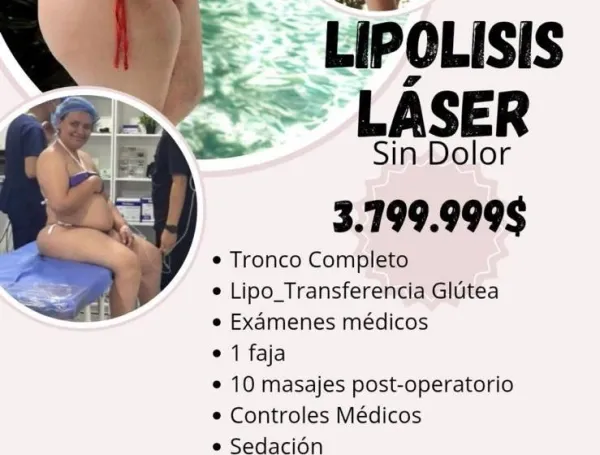 Este es el procedimiento estético al que se sometió Yulixa Toloza antes de desaparecer en Bogotá
