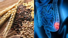 Este es el "superalimento" que ayuda a prevenir el cáncer de colon y el estreñimiento