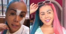 "Estoy arrepentida": Yina Calderón se borra los tatuajes del rostro
