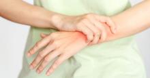 Factores que aumentan el riesgo de padecer artritis