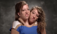 Las famosas siamesas Abby y Brittany Hensel hicieron sorprendente anuncio: ¿esperan un bebé?