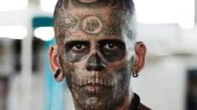 Así luce el hombre más tatuado de Brasil tras decidir eliminarlos