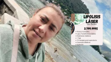 Este es el procedimiento estético al que se sometió Yulixa Toloza antes de desaparecer en Bogotá