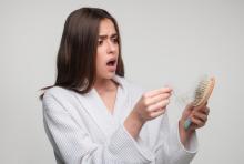 Caída abundante de cabello: estos son algunos hábitos que debería evitar